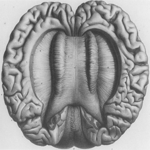 Το μεσολόβιο του ανθρώπινου εγκεφάλου από τον Άτλαντα Ανατομικής του Λουί Φοβίλλ (1844)