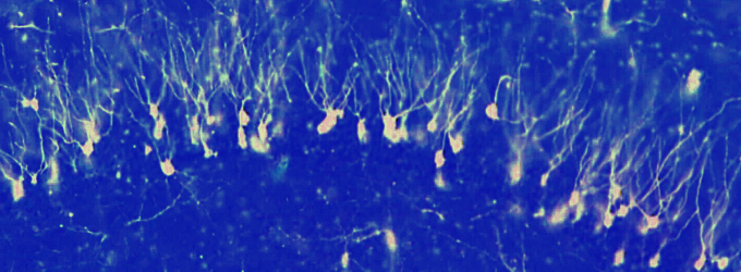 Mouse hippocampal neurons, Golgi method